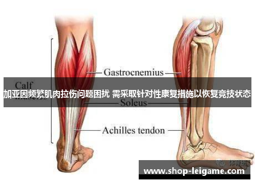 加亚因频繁肌肉拉伤问题困扰 需采取针对性康复措施以恢复竞技状态
