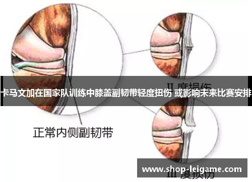 卡马文加在国家队训练中膝盖副韧带轻度扭伤 或影响未来比赛安排 卡马文加在国家队训练中膝盖副韧带轻度扭伤 或影响未来比赛安排